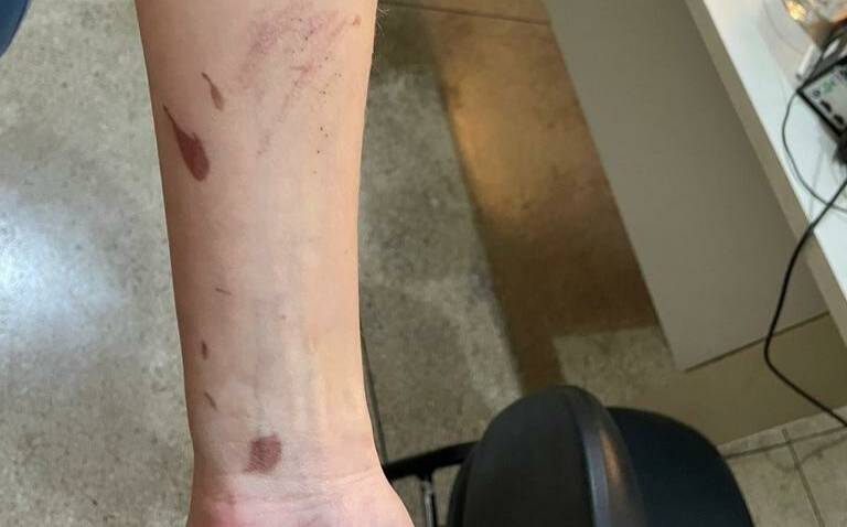 Enfermeiro é preso por estuprar paciente sedada após vítima ser levada a hospital por tentar tirar a própria vida 1 d23383db img 20230720 075920 1