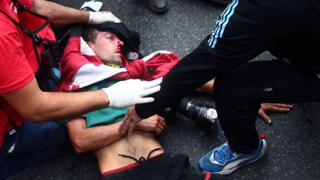 Protestos violentos na Argentina deixam jornalista ferido em estado grave 1 Argentina 1