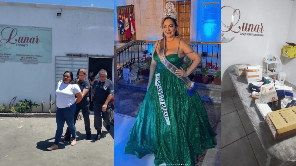 "Operação Beleza Sem BO": Mulher é Procurada pela Interpol por Lesão Corporal Grave em Procedimento Estético 7 "Operação Beleza Sem BO": Mulher é Procurada pela Interpol por Lesão Corporal Grave em Procedimento Estético