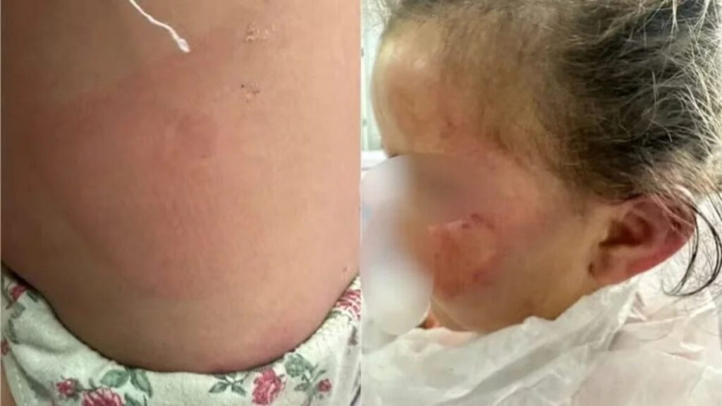 Mãe é Presa por Torturar e Espancar Filha de 3 Anos em Bela Vista de Goiás 8 Mãe é Presa por Torturar Filha