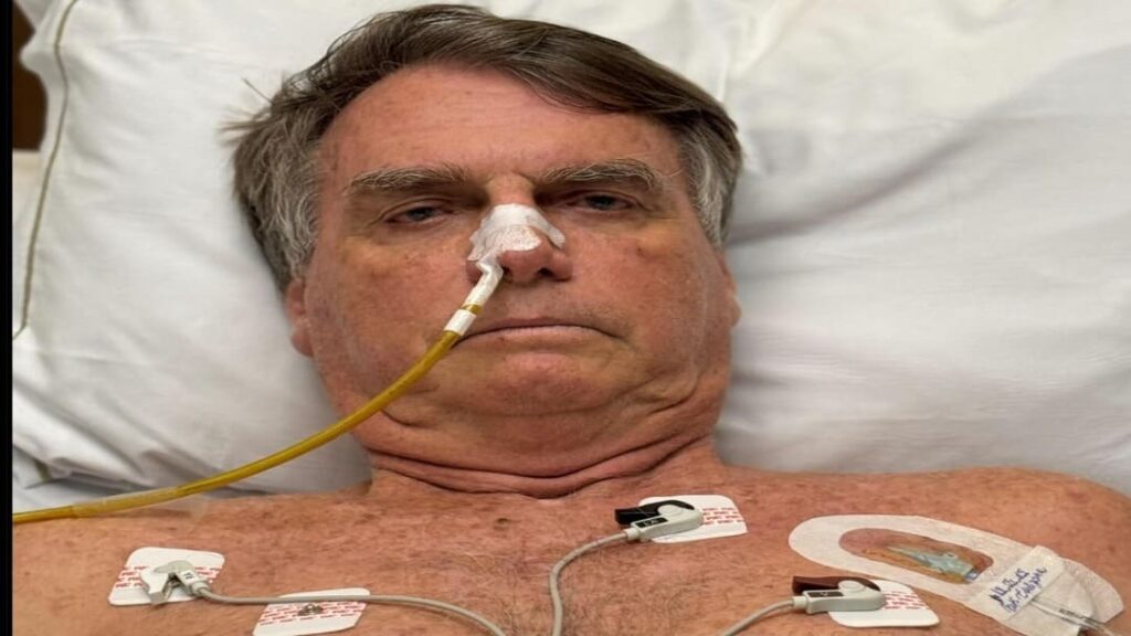 Bolsonaro Apresenta Piora no Quadro de Saúde, Segundo Médicos 2 Bolsonaro apresenta piora