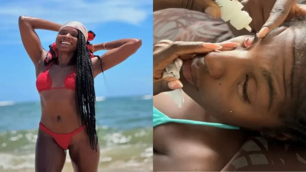 Modelo Perde a Visão Temporariamente Após Usar Pomada Modeladora no Cabelo 7 Modelo fica sem visão após uso de pomada