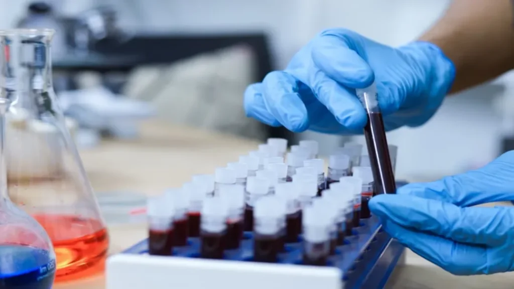 EUA Aprova Primeiro Exame de Sangue para Diagnóstico de Alzheimer 5 diagnostico Alzheimer