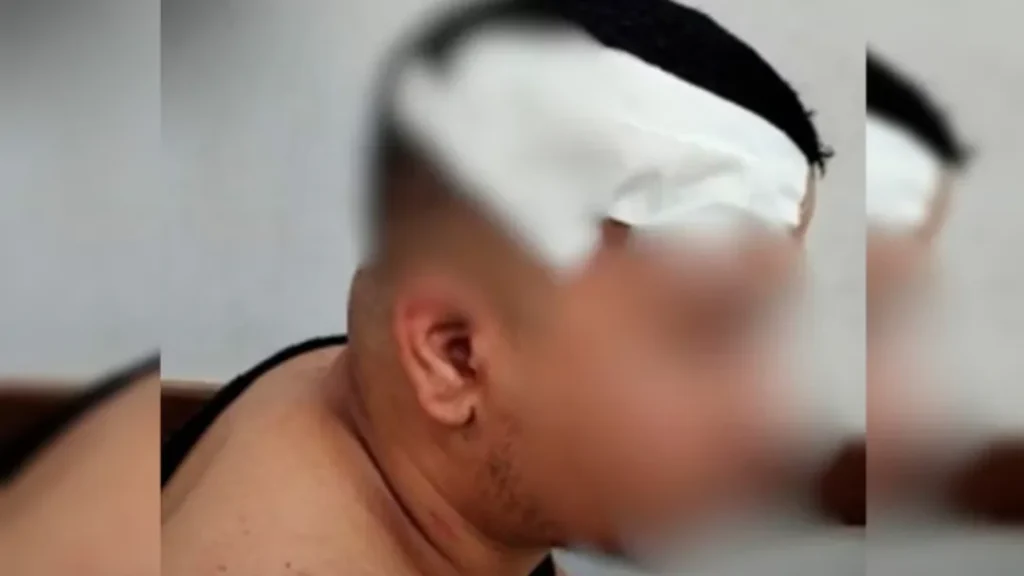 Jovem é Agredido com Pedaço de Madeira Após Brincadeira Durante Partida de Truco em Goiânia 2 Jovem agredido durante jogo