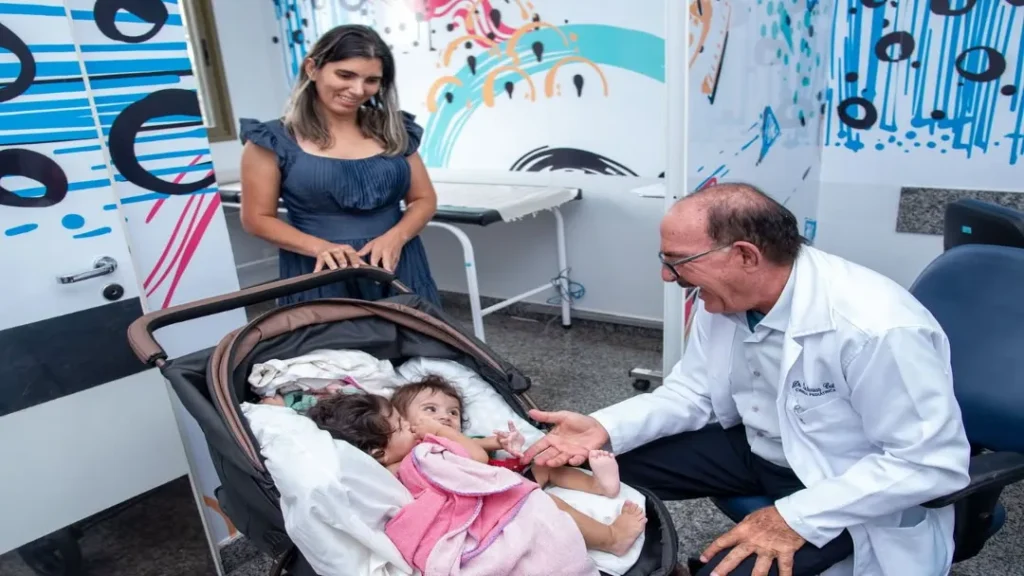 Gêmeas Siamesas Kiraz e Aruna São Internadas no Hecad para Cirurgia de Separação 4 Separação Gemeas Siamesas