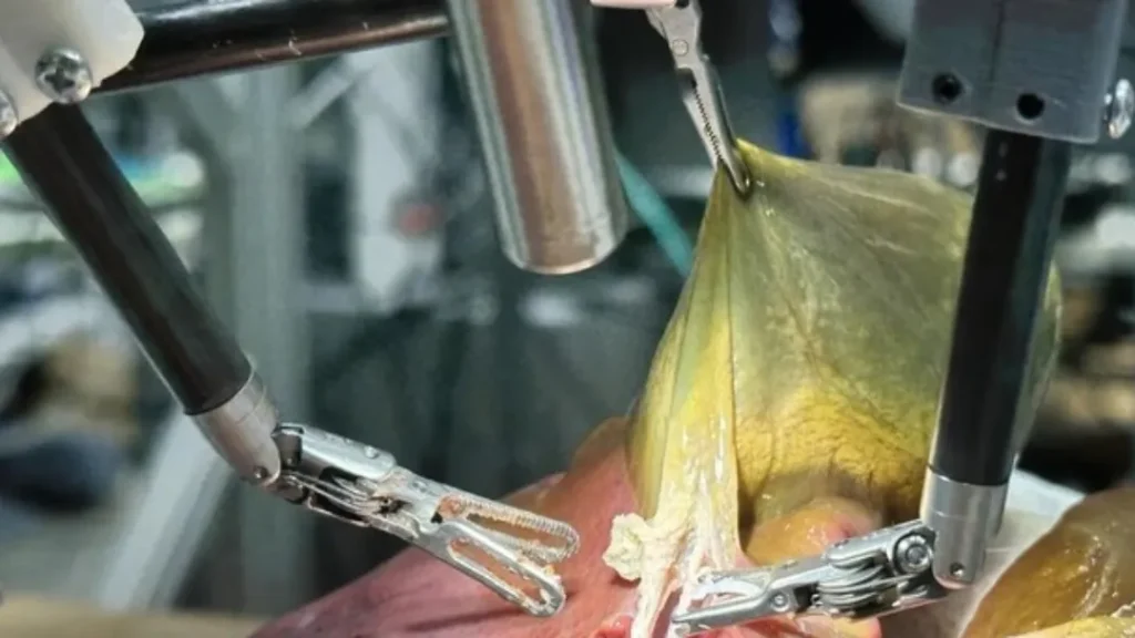 Robô Realiza Cirurgia Autônoma com Inteligência Artificial 5 Robô Realiza Cirurgia Autônoma com Inteligência Artificial