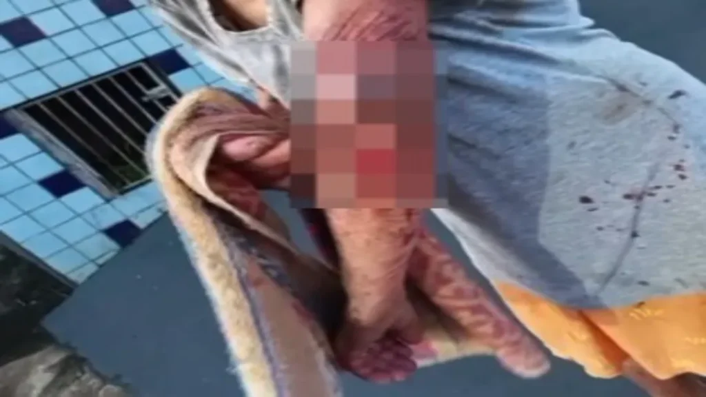 Homem é Detido por Suspeita de Agredir Avó de 85 Anos em Morrinhos 11 Homem é Detido por Suspeita de Agredir Avó de 85 Anos em Morrinhos