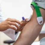 Novo exame de sangue detecta sinais de Alzheimer