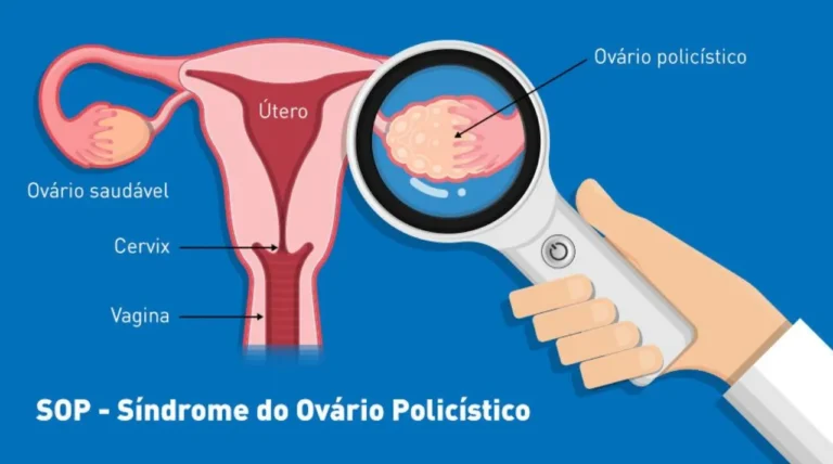 Sinais no corpo podem indicar desequilíbrio hormonal